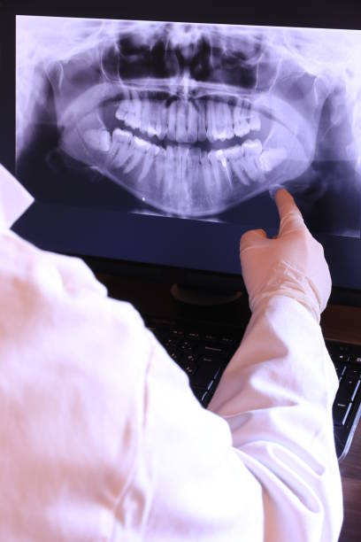Best Walk-In Emergency Dentist in North Caldwell, NJ