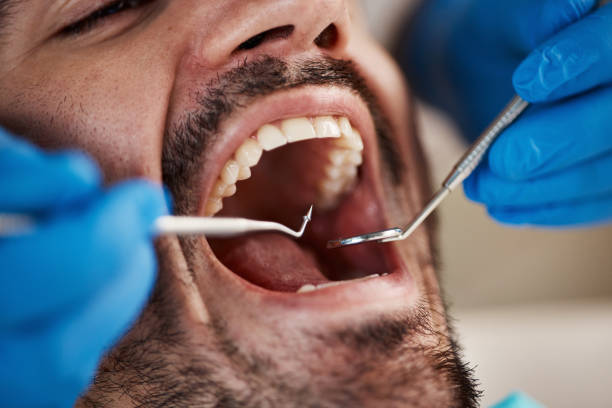 Best Walk-In Emergency Dentist in North Caldwell, NJ